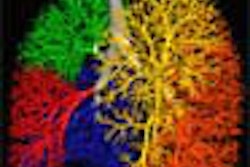 2003 11 17 11 27 57 706