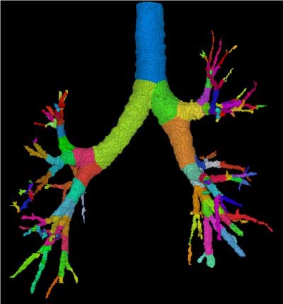 2003 11 17 11 28 42 706