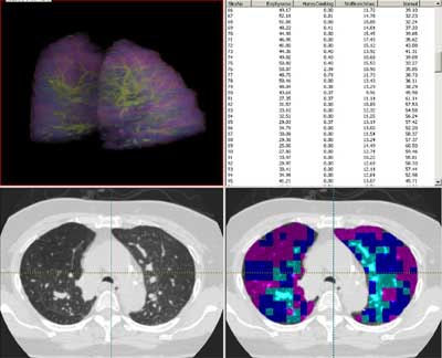 2003 11 17 11 32 01 706