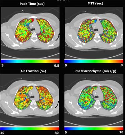 2003 11 17 11 33 08 706