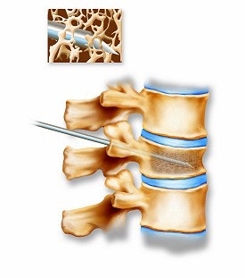 2003 11 17 16 05 43 706