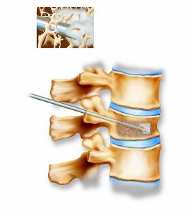 2003 11 17 16 10 12 706