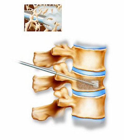 2003 11 17 16 10 12 706