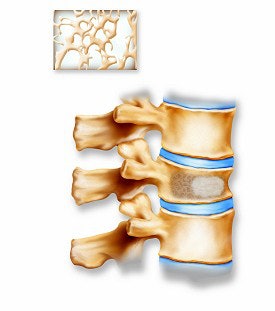 2003 11 17 16 10 47 706