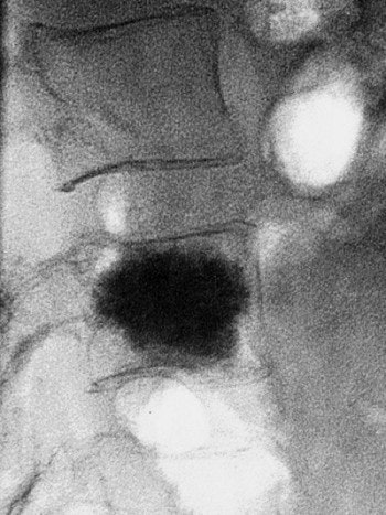 2003 11 17 16 14 47 706