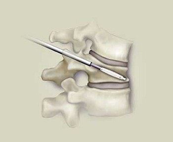 2003 11 17 17 05 46 706