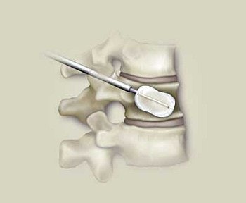 2003 11 17 17 06 32 706