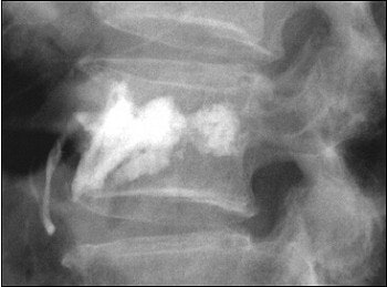 2003 11 17 17 11 42 706