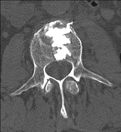 2003 11 17 17 12 37 706