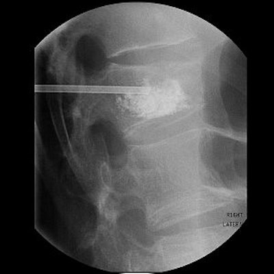 2003 11 18 15 47 08 706