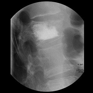 2003 11 18 15 47 40 706