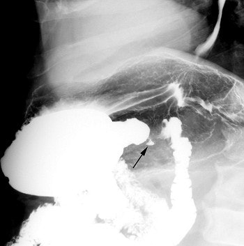 2003 11 25 16 45 26 706