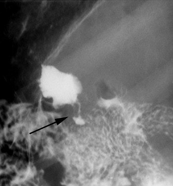 2003 11 25 16 45 58 706