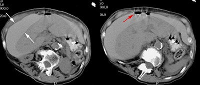 2003 11 25 16 48 54 706