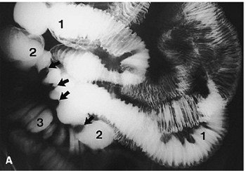 2003 11 25 16 51 35 706