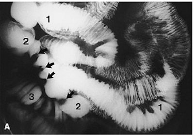 2003 11 25 16 51 35 706