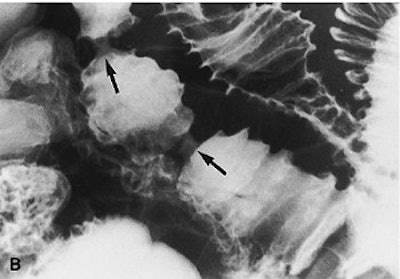 2003 11 25 16 52 10 706