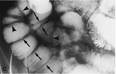 2003 11 25 16 52 34 706