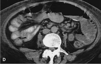 2003 11 25 16 55 47 706