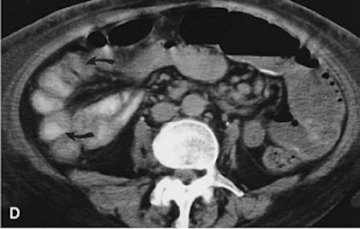 2003 11 25 16 55 47 706