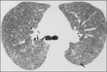 2003 11 25 16 59 50 706