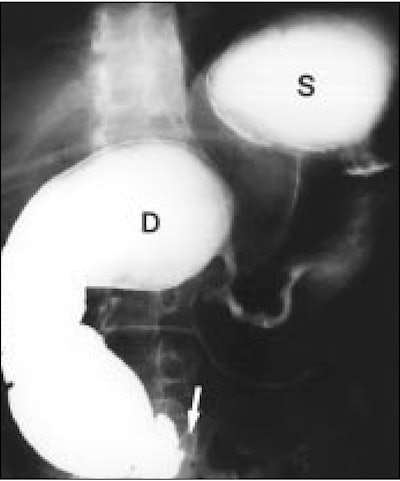 2003 11 25 17 05 25 706