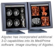 Algotec Pacs