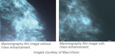 Maxxvision Wom