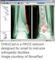 Novarad Pacs