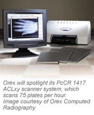 Oregon Arrayrx Orex Computed Radiography | AuntMinnie