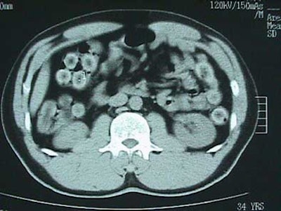 2003 11 30 21 25 04 706