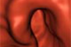 2003 12 15 12 23 13 706