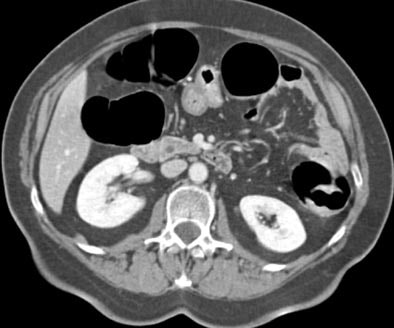 2003 12 15 12 23 50 706