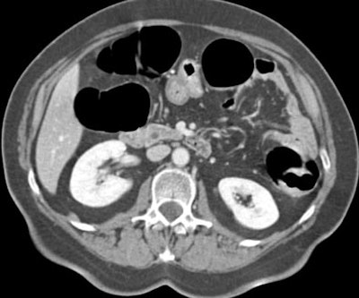 2003 12 15 12 23 50 706