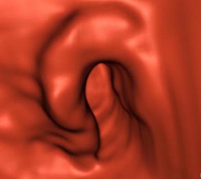 2003 12 15 12 24 27 706