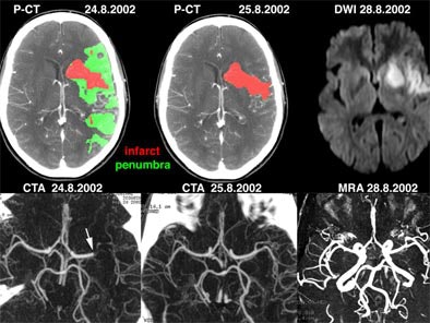 2003 12 23 14 39 18 706