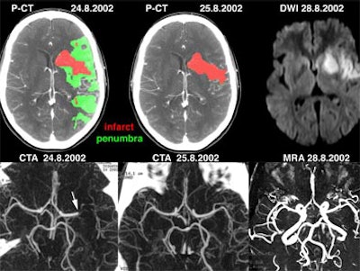 2003 12 23 14 39 18 706