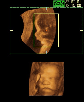 2003 12 24 10 26 49 706