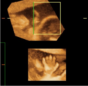 2003 12 24 10 27 06 706