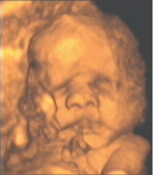 2003 12 24 10 27 26 706