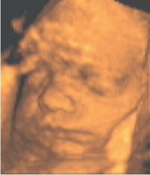 2003 12 24 10 27 47 706