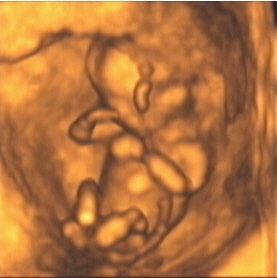 2003 12 30 14 23 52 706