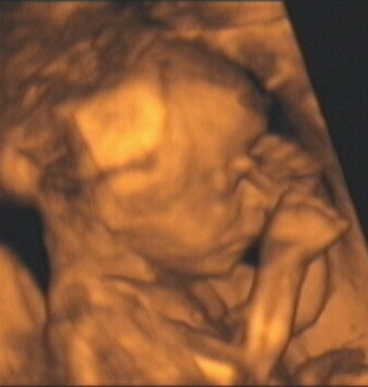 2003 12 30 14 24 12 706