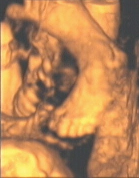 2003 12 30 14 24 32 706