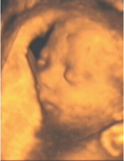 2003 12 30 14 24 54 706