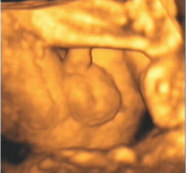 2003 12 30 14 26 42 706