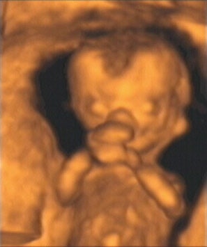 2003 12 30 14 27 17 706