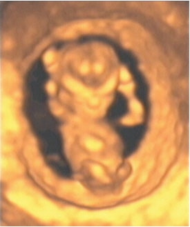 2003 12 30 14 27 34 706