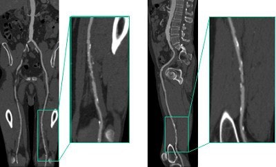 2004 01 02 12 09 28 706