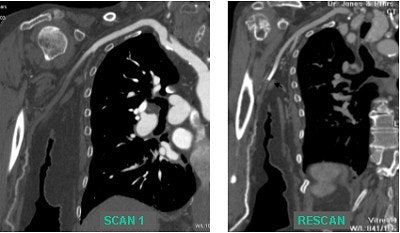 2004 01 02 12 12 01 706